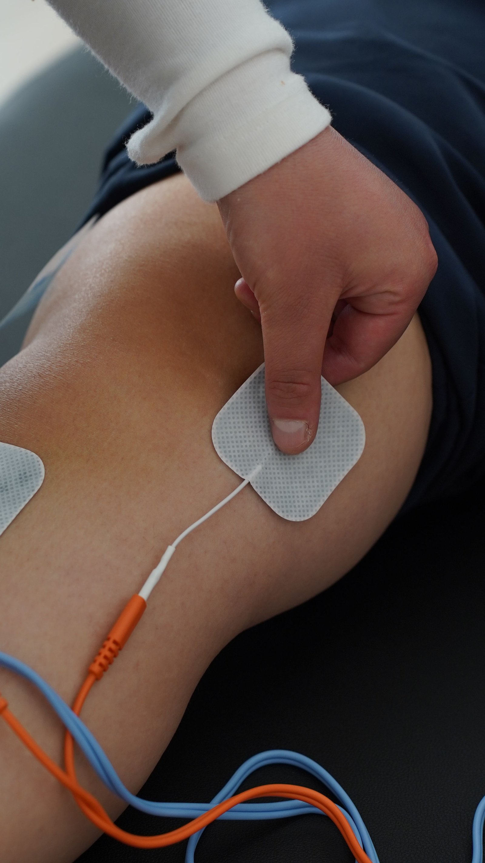 Stimulation Therapy